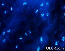 图为荧光显微镜学应用于被紫外线激发的 DAPI 斑点